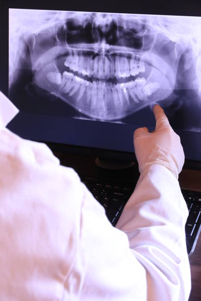 Best Emergency Root Canal Treatment in Edgewood, TX